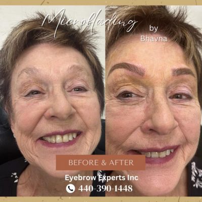 Microblading, Microneedling Pigmentation