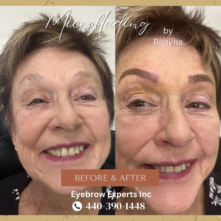 Microblading, Microneedling Pigmentation
