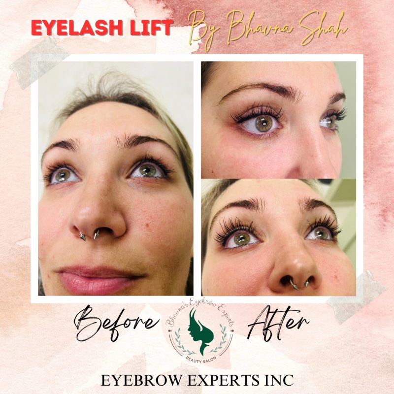 Eyelash Lift