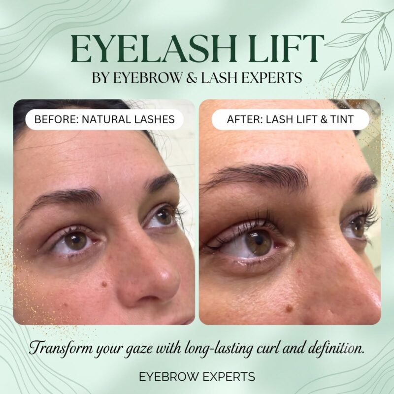 Eyelash Lift